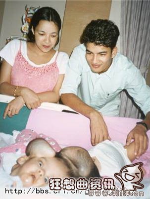2001年3月19日，新加坡总医院，桑德娅·什勒斯萨和丈夫K.C.布沙恩注视着他们的双胞胎女儿。4月，经过90多个小时的手术，医生成功为这对连体婴儿实施了分离手术。