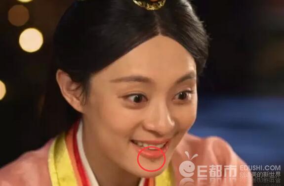 孙俪的痣