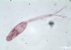 日本血吸虫尾蚴图片，日本血吸虫生活史过程图